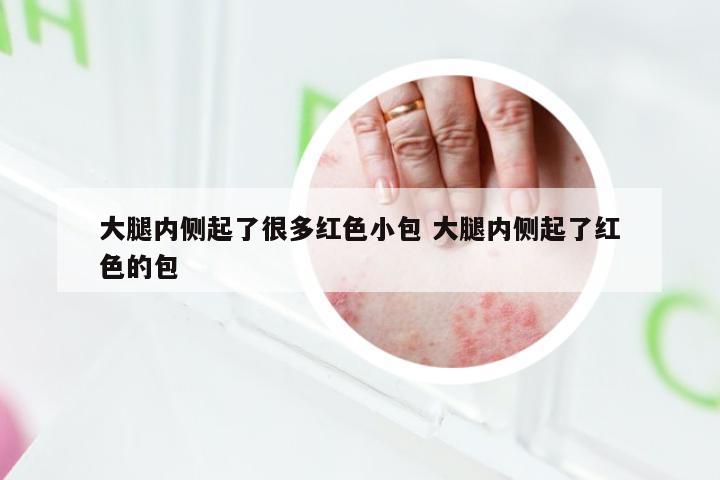 大腿内侧起了很多红色小包 大腿内侧起了红色的包