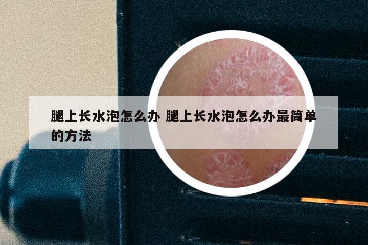 腿上长水泡怎么办 腿上长水泡怎么办最简单的方法