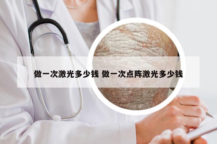 做一次激光多少钱 做一次点阵激光多少钱