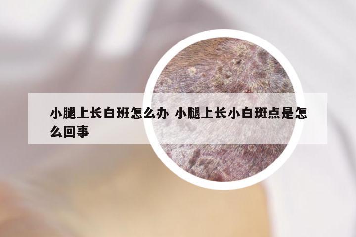 小腿上长白班怎么办 小腿上长小白斑点是怎么回事