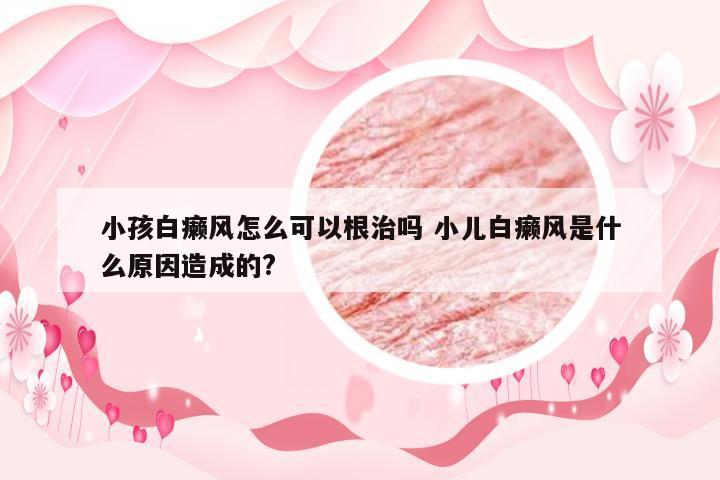 小孩白癞风怎么可以根治吗 小儿白癞风是什么原因造成的?