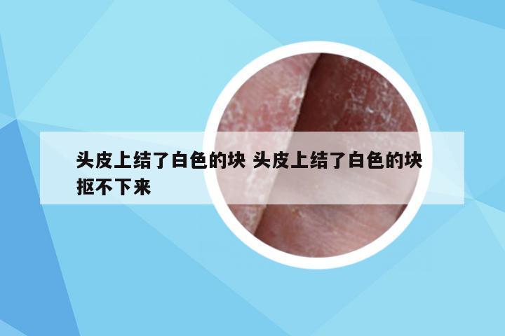 头皮上结了白色的块 头皮上结了白色的块 抠不下来