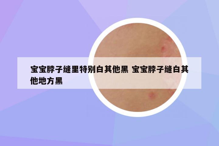 宝宝脖子缝里特别白其他黑 宝宝脖子缝白其他地方黑