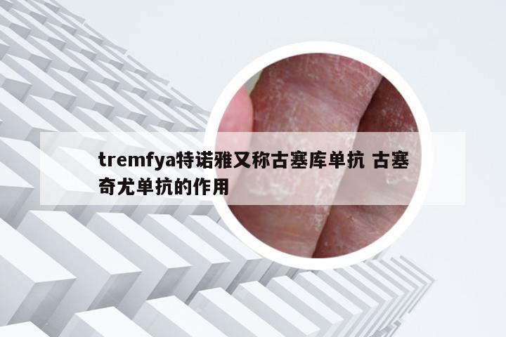 tremfya特诺雅又称古塞库单抗 古塞奇尤单抗的作用