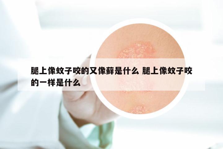 腿上像蚊子咬的又像藓是什么 腿上像蚊子咬的一样是什么