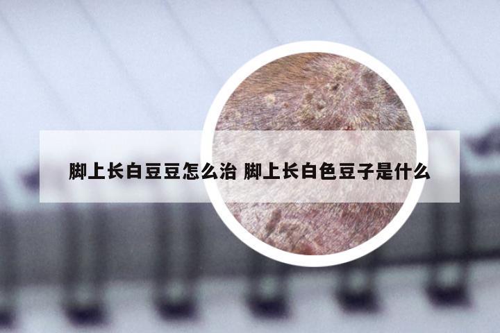 脚上长白豆豆怎么治 脚上长白色豆子是什么