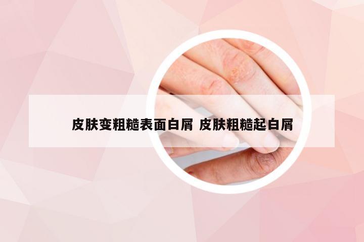 皮肤变粗糙表面白屑 皮肤粗糙起白屑