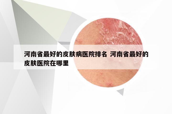 河南省最好的皮肤病医院排名 河南省最好的皮肤医院在哪里