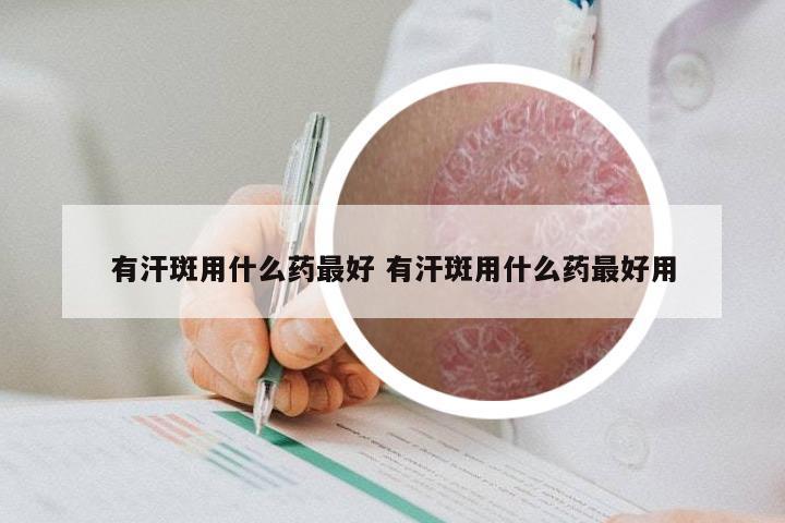 有汗斑用什么药最好 有汗斑用什么药最好用