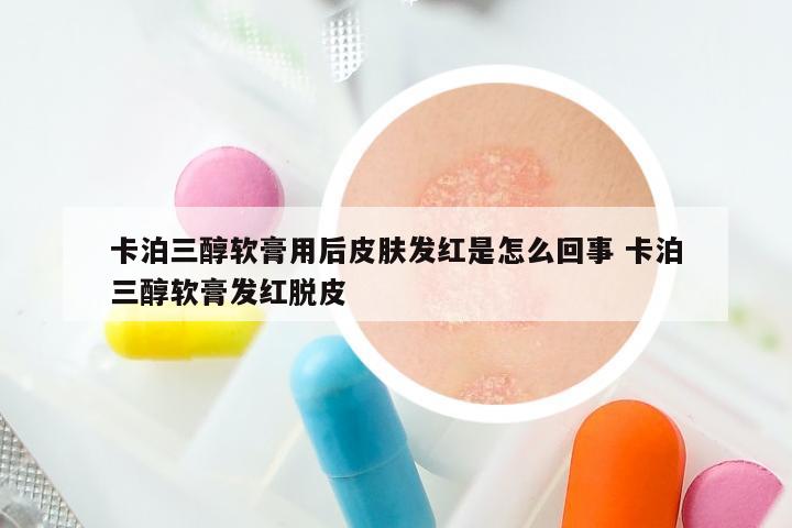 卡泊三醇软膏用后皮肤发红是怎么回事 卡泊三醇软膏发红脱皮