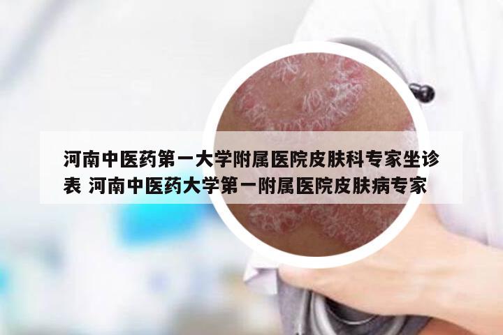 河南中医药第一大学附属医院皮肤科专家坐诊表 河南中医药大学第一附属医院皮肤病专家