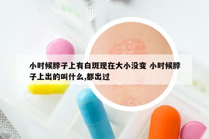 小时候脖子上有白斑现在大小没变 小时候脖子上出的叫什么,都出过