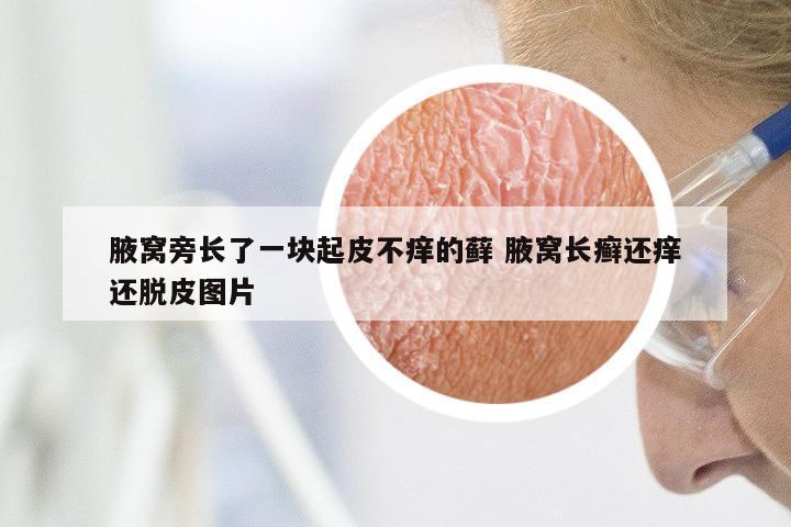 腋窝旁长了一块起皮不痒的藓 腋窝长癣还痒还脱皮图片