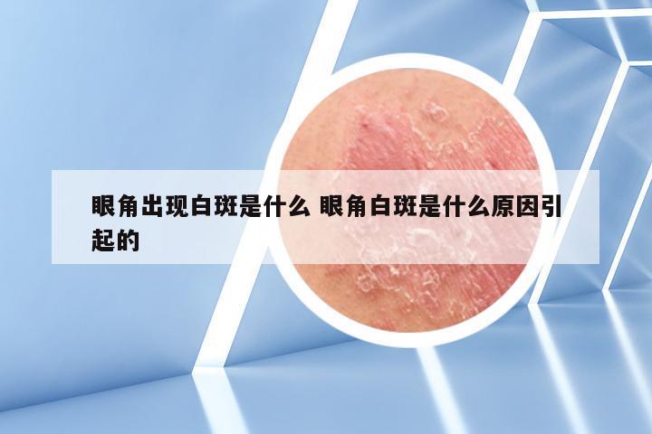 眼角出现白斑是什么 眼角白斑是什么原因引起的