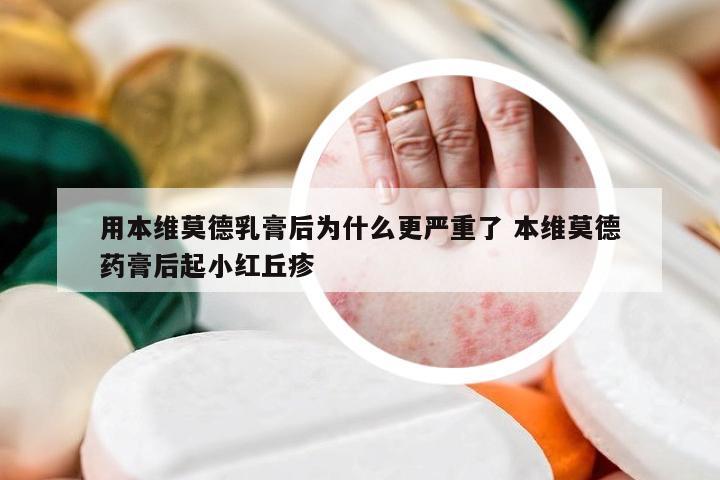 用本维莫德乳膏后为什么更严重了 本维莫德药膏后起小红丘疹