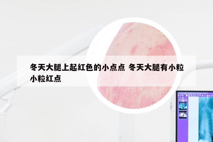 冬天大腿上起红色的小点点 冬天大腿有小粒小粒红点