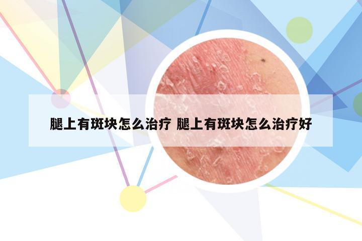 腿上有斑块怎么治疗 腿上有斑块怎么治疗好