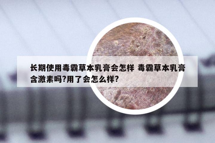 长期使用毒霸草本乳膏会怎样 毒霸草本乳膏含激素吗?用了会怎么样?