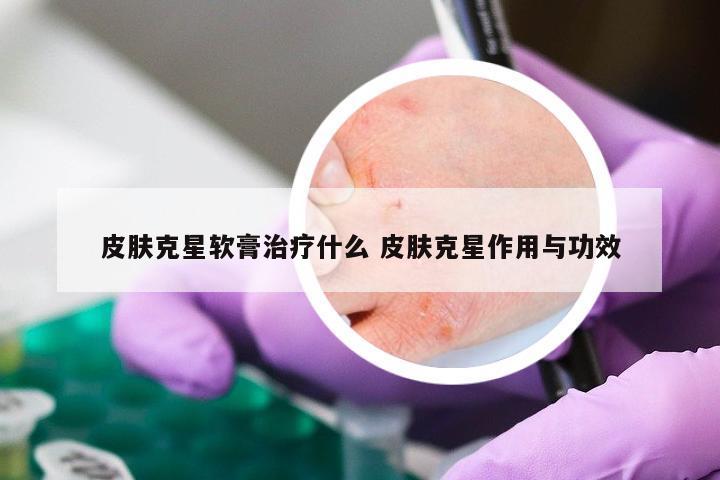 皮肤克星软膏治疗什么 皮肤克星作用与功效