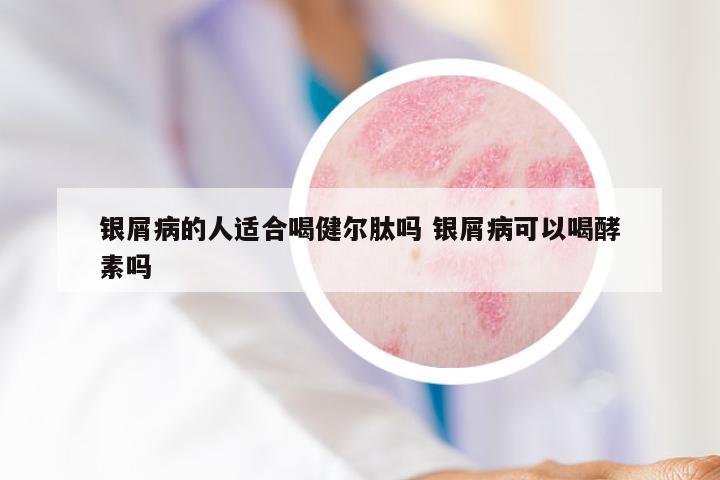 银屑病的人适合喝健尔肽吗 银屑病可以喝酵素吗