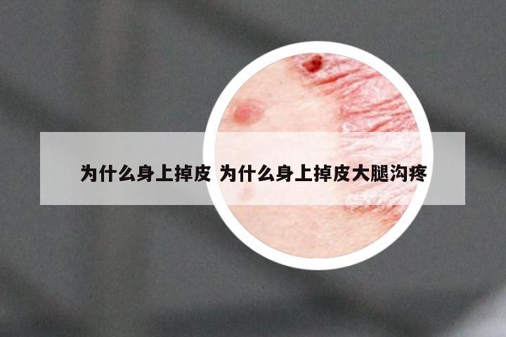 为什么身上掉皮 为什么身上掉皮大腿沟疼