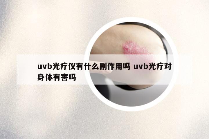 uvb光疗仪有什么副作用吗 uvb光疗对身体有害吗