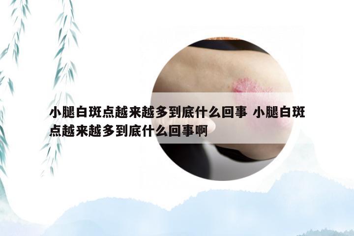 小腿白斑点越来越多到底什么回事 小腿白斑点越来越多到底什么回事啊