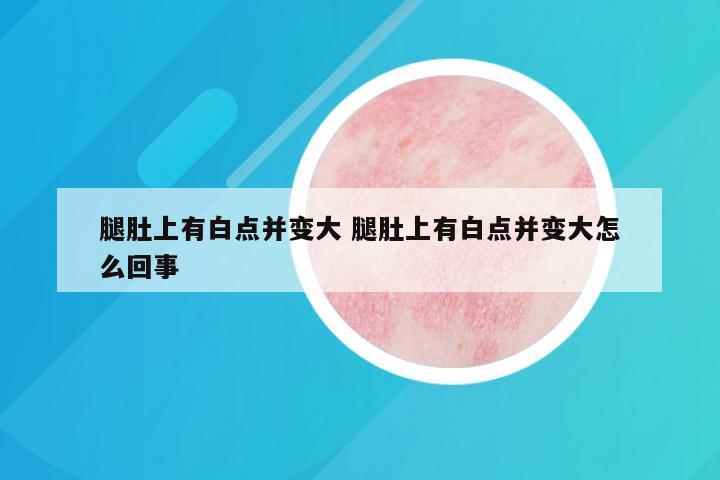 腿肚上有白点并变大 腿肚上有白点并变大怎么回事