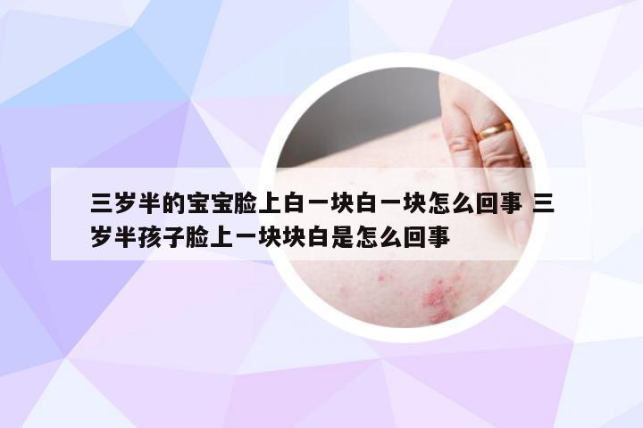 三岁半的宝宝脸上白一块白一块怎么回事 三岁半孩子脸上一块块白是怎么回事