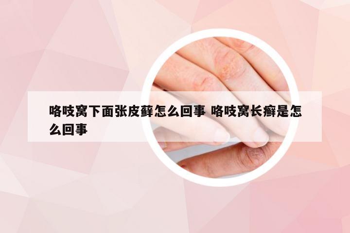 咯吱窝下面张皮藓怎么回事 咯吱窝长癣是怎么回事