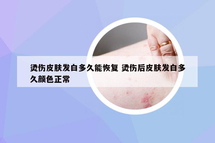 烫伤皮肤发白多久能恢复 烫伤后皮肤发白多久颜色正常