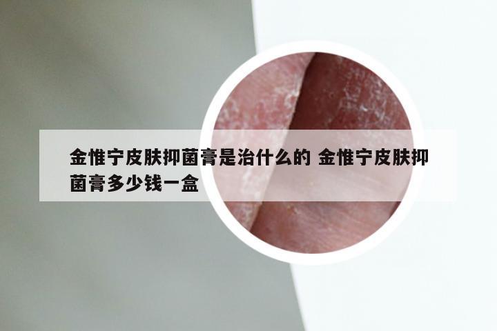 金惟宁皮肤抑菌膏是治什么的 金惟宁皮肤抑菌膏多少钱一盒