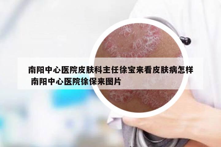 南阳中心医院皮肤科主任徐宝来看皮肤病怎样 南阳中心医院徐保来图片