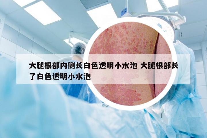 大腿根部内侧长白色透明小水泡 大腿根部长了白色透明小水泡