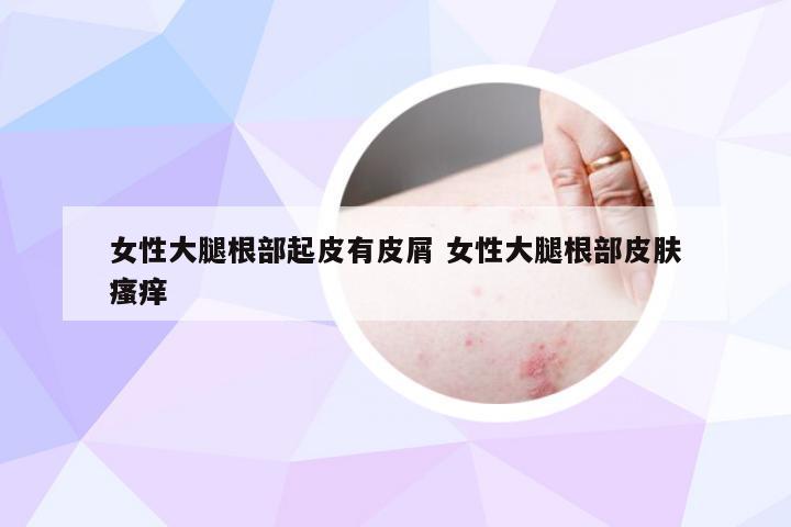 女性大腿根部起皮有皮屑 女性大腿根部皮肤瘙痒