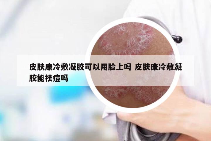 皮肤康冷敷凝胶可以用脸上吗 皮肤康冷敷凝胶能祛痘吗