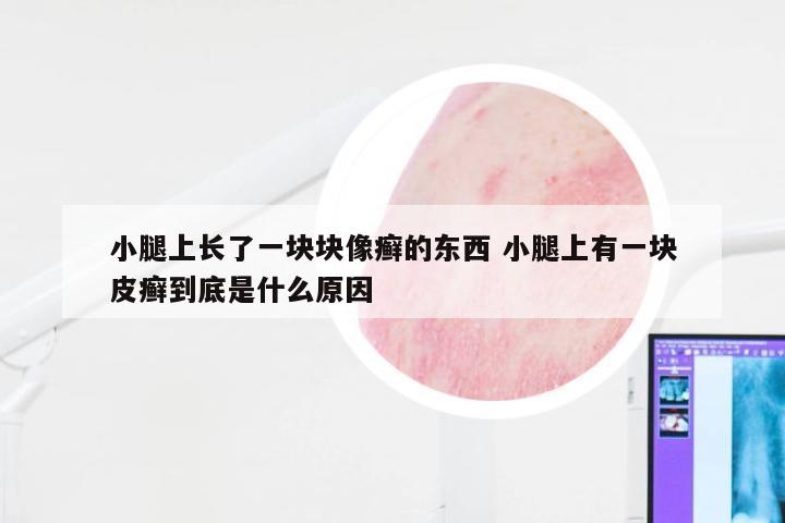 小腿上长了一块块像癣的东西 小腿上有一块皮癣到底是什么原因