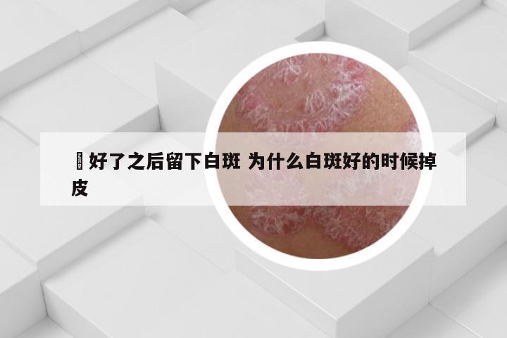 廯好了之后留下白斑 为什么白斑好的时候掉皮