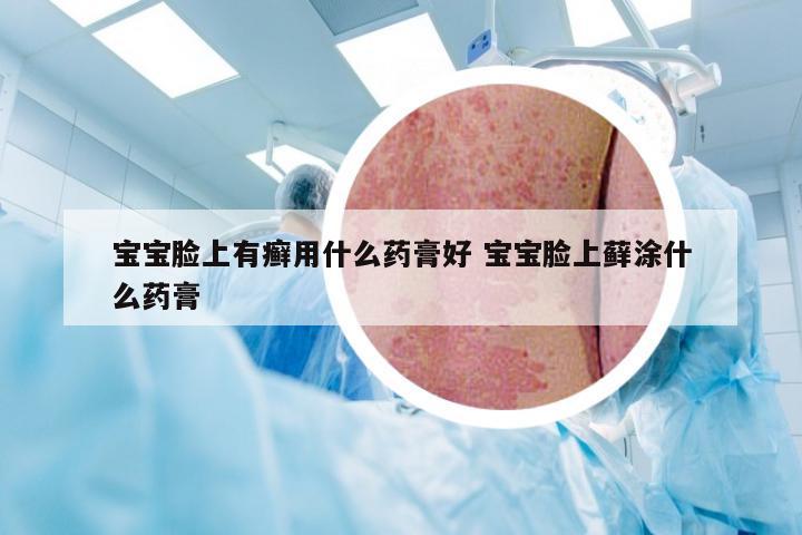 宝宝脸上有癣用什么药膏好 宝宝脸上藓涂什么药膏