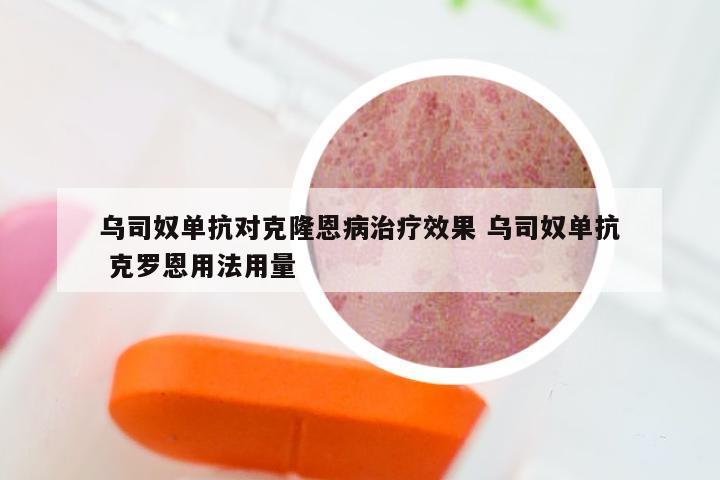 乌司奴单抗对克隆恩病治疗效果 乌司奴单抗 克罗恩用法用量