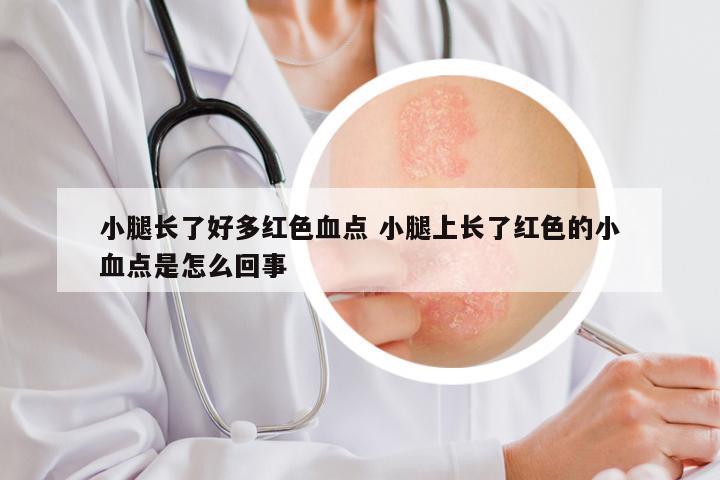 小腿长了好多红色血点 小腿上长了红色的小血点是怎么回事