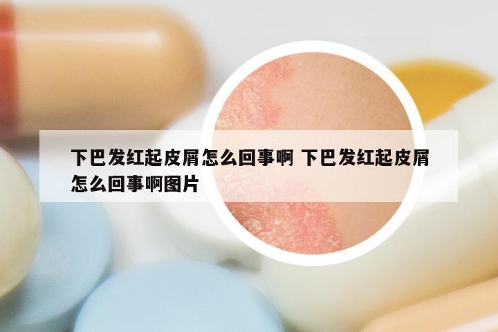 下巴发红起皮屑怎么回事啊 下巴发红起皮屑怎么回事啊图片