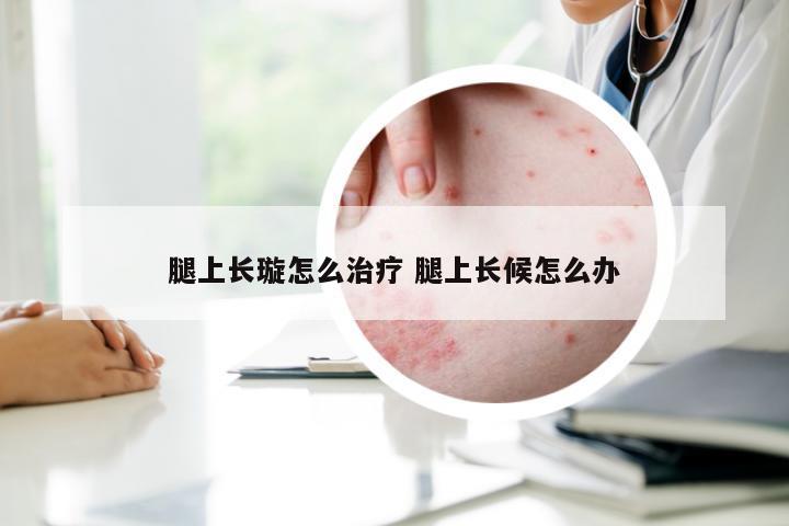 腿上长璇怎么治疗 腿上长候怎么办