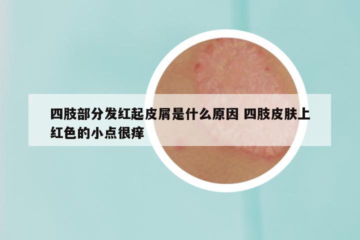 四肢部分发红起皮屑是什么原因 四肢皮肤上红色的小点很痒