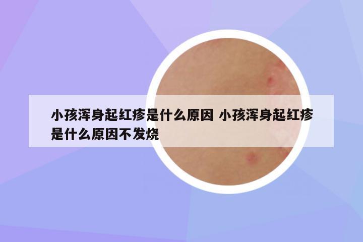 小孩浑身起红疹是什么原因 小孩浑身起红疹是什么原因不发烧