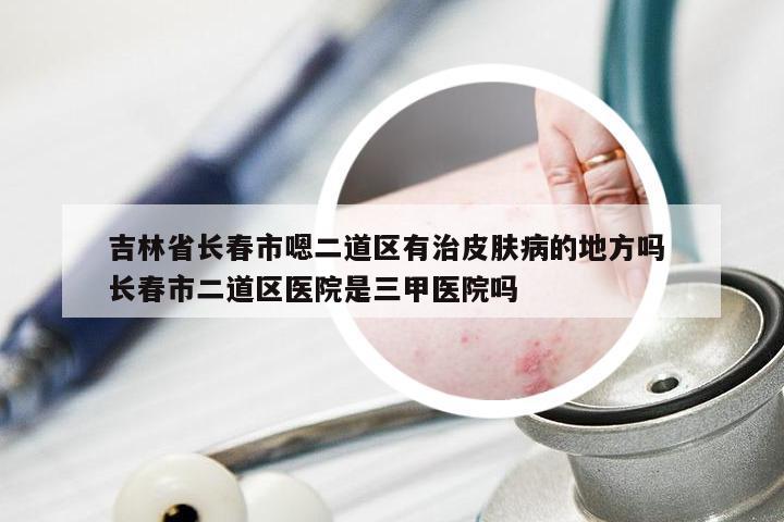 吉林省长春市嗯二道区有治皮肤病的地方吗 长春市二道区医院是三甲医院吗