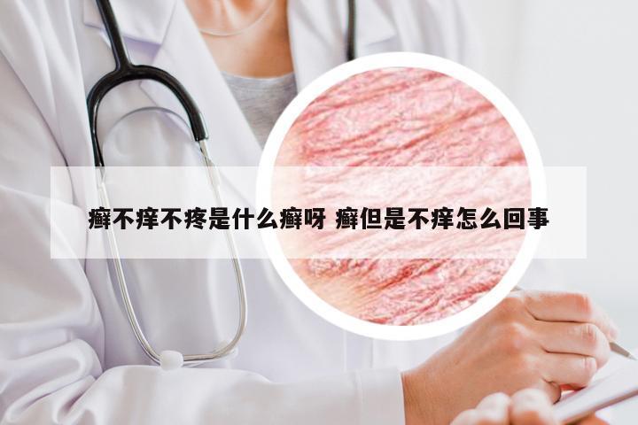 癣不痒不疼是什么癣呀 癣但是不痒怎么回事