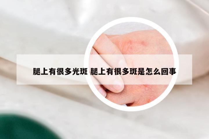 腿上有很多光斑 腿上有很多斑是怎么回事