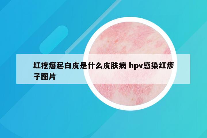 红疙瘩起白皮是什么皮肤病 hpv感染红疹子图片