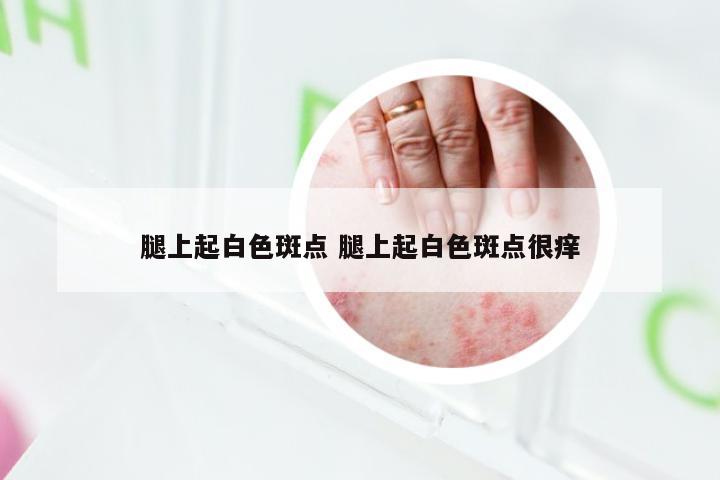 腿上起白色斑点 腿上起白色斑点很痒